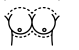 Mastoplastica Additiva 