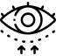 Blefaroplastica