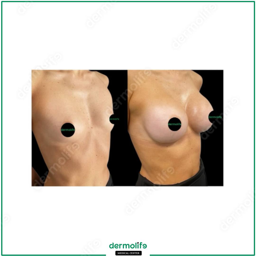 plastic surgery clinic italy 