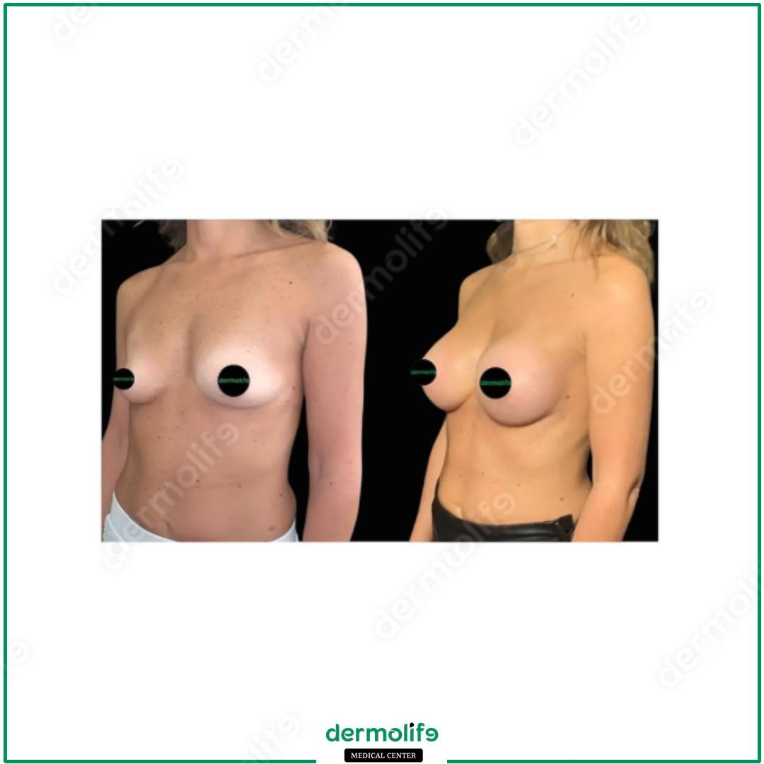 plastic surgery clinic italy 