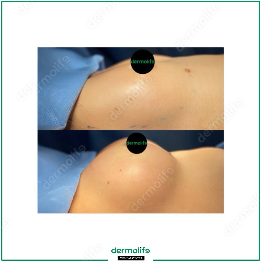 plastic surgery clinic italy 