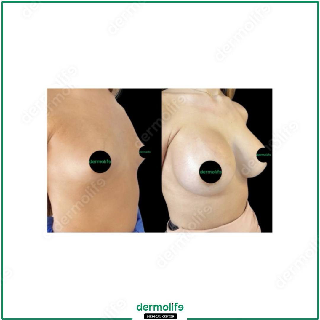 plastic surgery clinic italy 