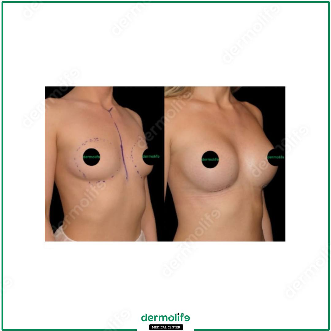 plastic surgery clinic italy 