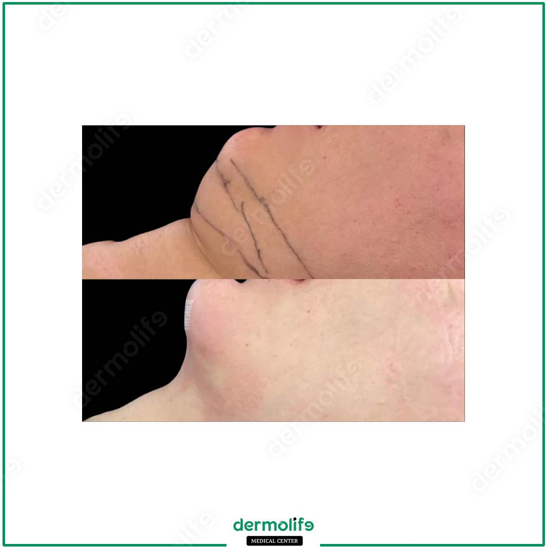 chin reshaping aesthetic clinic italy 
