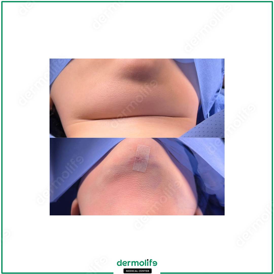 chin reshaping aesthetic clinic italy 