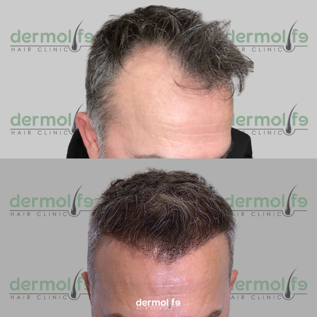 capelli clinica estetica italy 