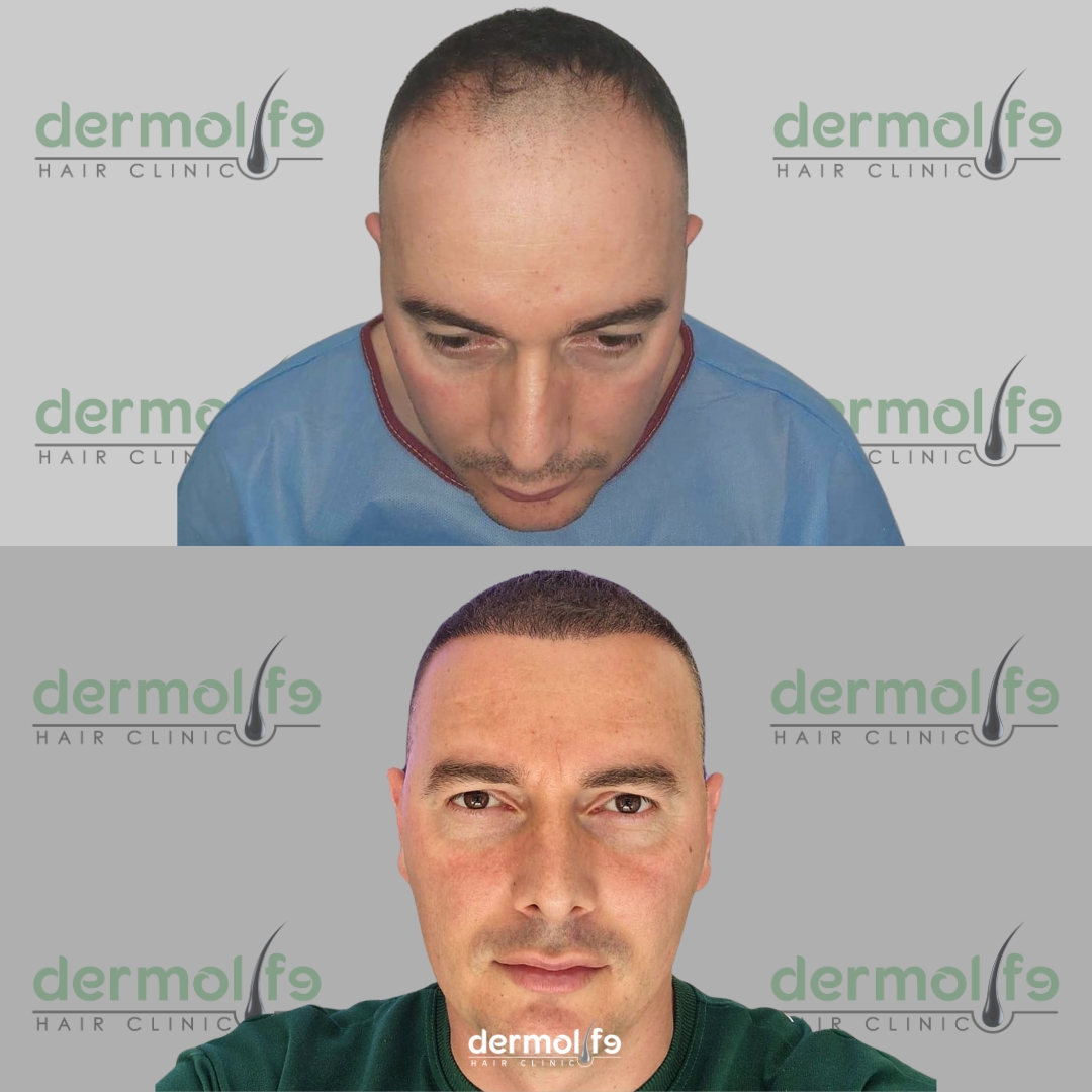 capelli clinica estetica italy 