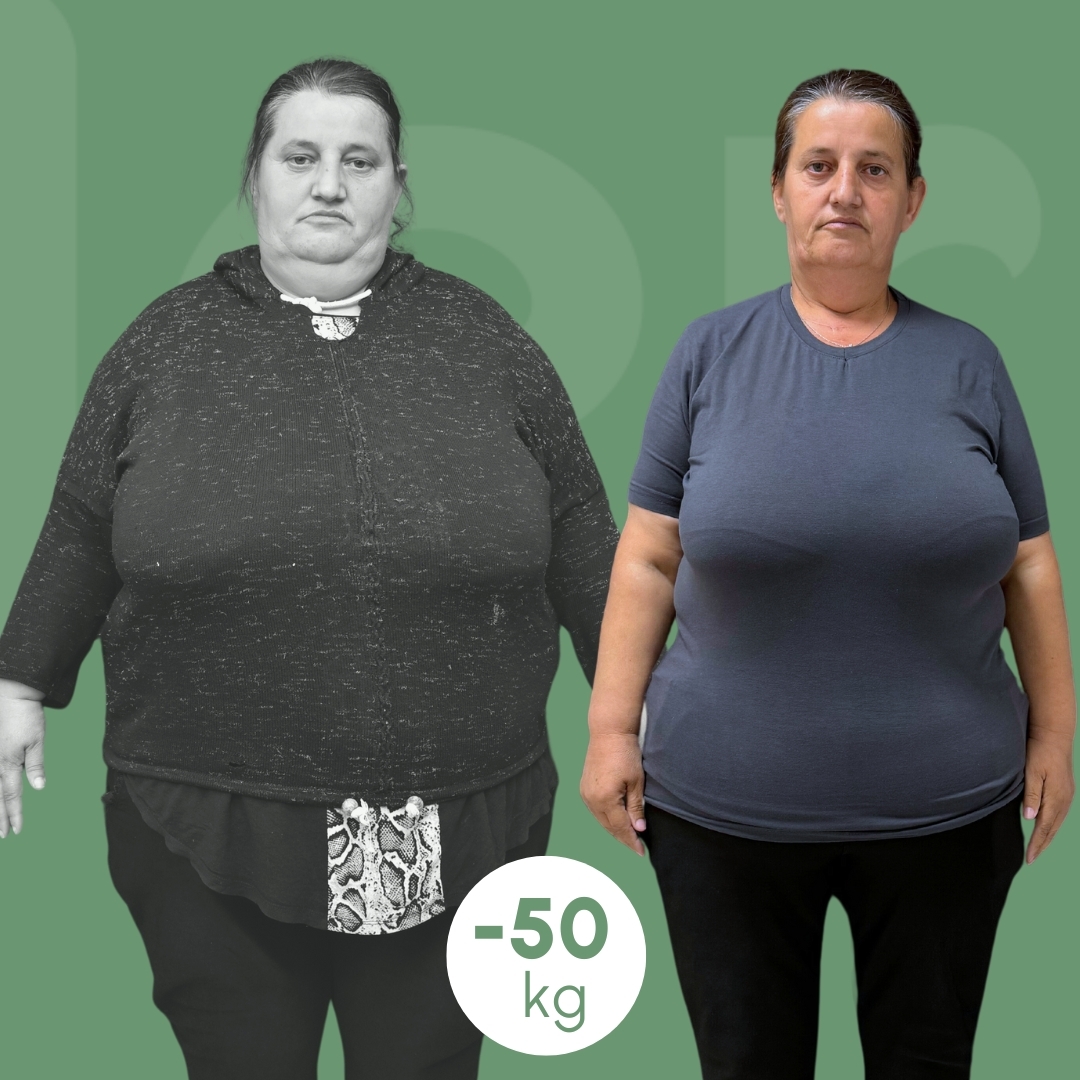 sleeve clinica estetica italy 