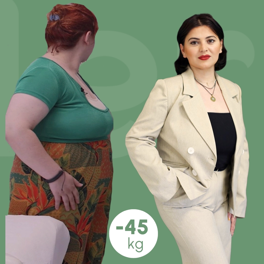 sleeve clinica estetica italy 