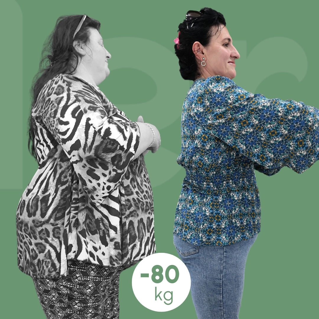 sleeve clinica estetica italy 