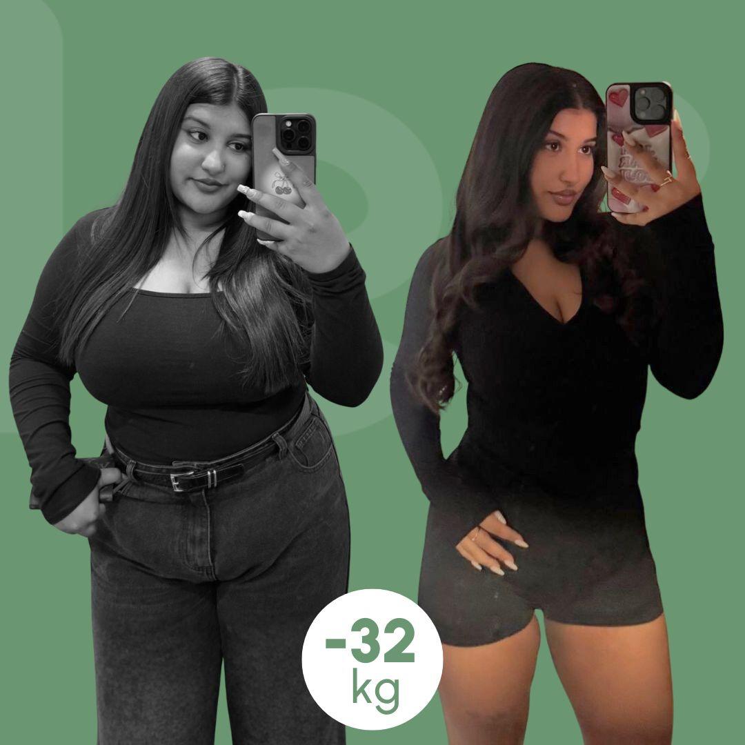 sleeve clinica estetica italy 